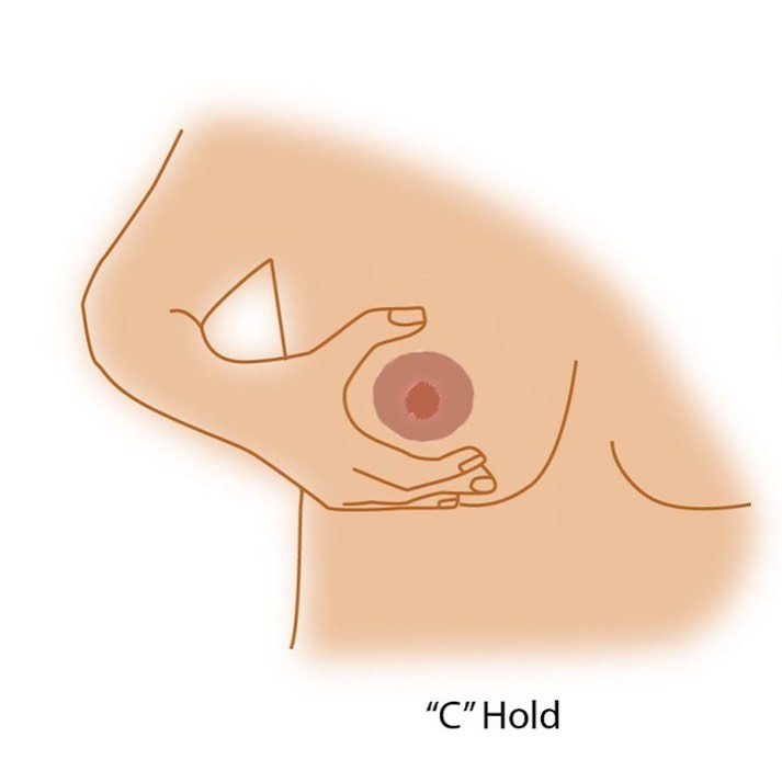 Breastfeeding with Flat and Inverted Nipples